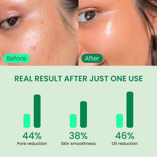 No More Pore Pads